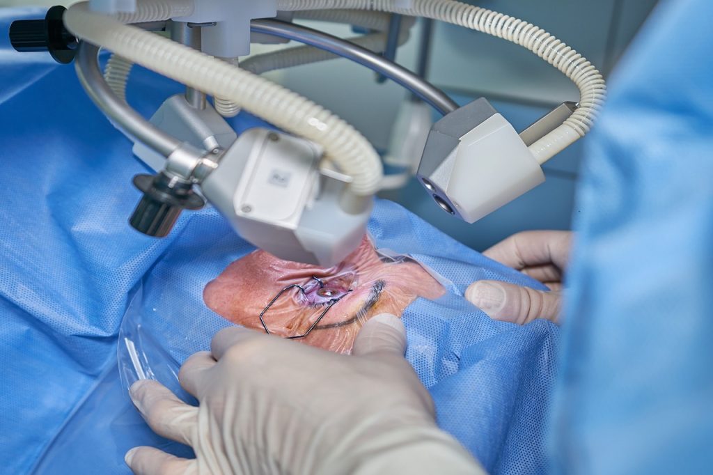 laseroterapia siatkowki
